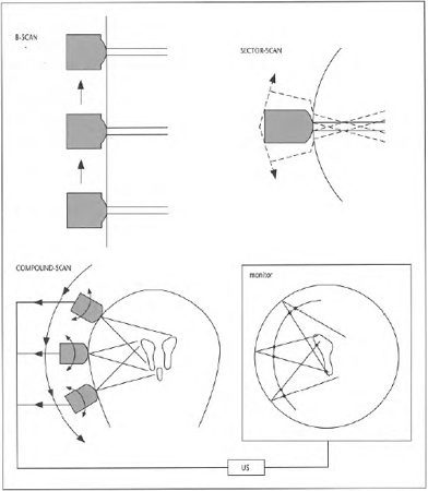 illustratie