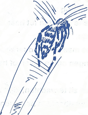 illustratie
