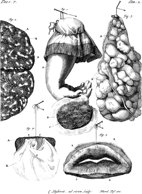 illustratie